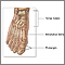 Bunion removal - Series Bunion removal - Series