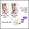 Aminoaciduria urine test Aminoaciduria urine test