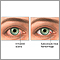 Bloodshot eyes Bloodshot eyes