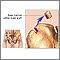 Bone marrow from hip Bone marrow from hip