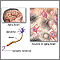 Aged nervous tissue Aged nervous tissue