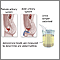 Aldosterone level test Aldosterone level test