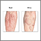 Allergic reactions Allergic reactions