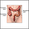 Large intestine Large intestine