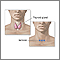Incision for thyroid gland surgery