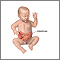 Infant intestines Infant intestines