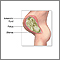 Amniotic fluid Amniotic fluid