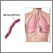 Bacillus anthracis Bacillus anthracis