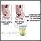 Catecholamine urine test Catecholamine urine test