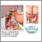 Duodenal tissue culture