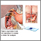 Duodenum tissue smear Duodenum tissue smear