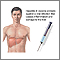 Hepatitis B Hepatitis B