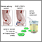 Leucine aminopeptidase urine test Leucine aminopeptidase urine test