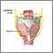 Laryngeal nerve damage Laryngeal nerve damage