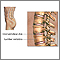 Lumbar vertebrae Lumbar vertebrae