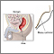 Rectal biopsy Rectal biopsy