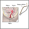Endometrial biopsy Endometrial biopsy