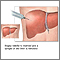 Liver culture Liver culture