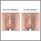 Male reproductive hygiene Male reproductive hygiene