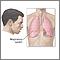 Symptoms Symptoms