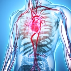 Aneurysms