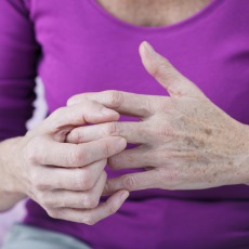 Arthritis