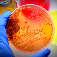 E. Coli Infections