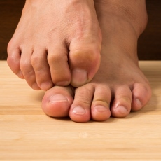 Fungal Infections