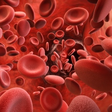 Hemochromatosis