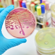 Infectious Diseases