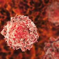 Leukemia