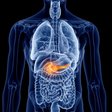 Pancreatitis