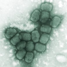 Smallpox