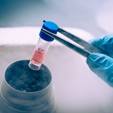 Stem Cells