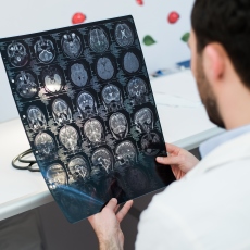Traumatic Brain Injury