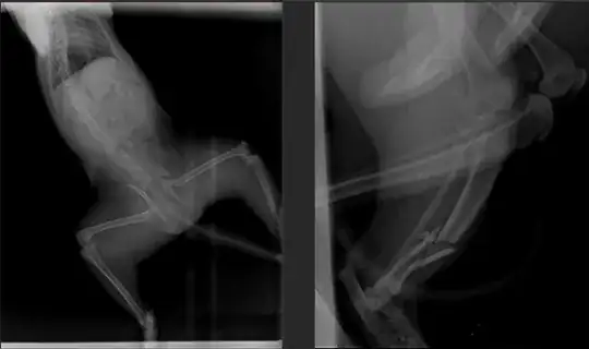 X-ray
