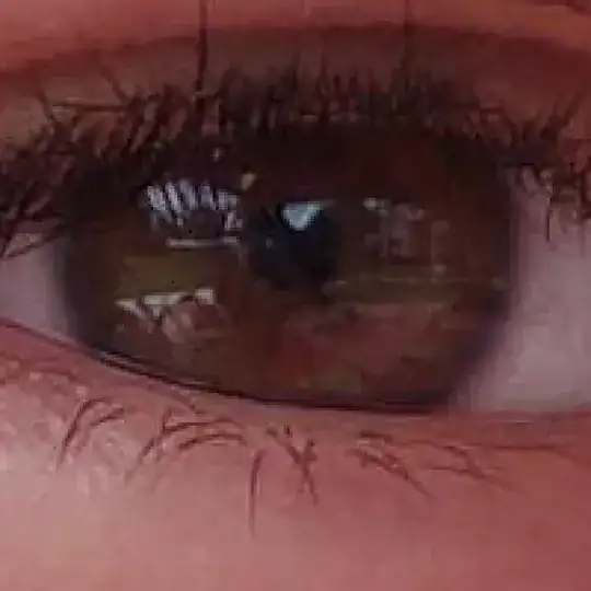 crop of eye from preview