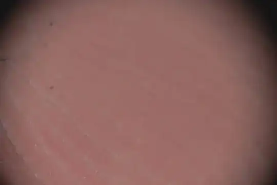 My Finger!