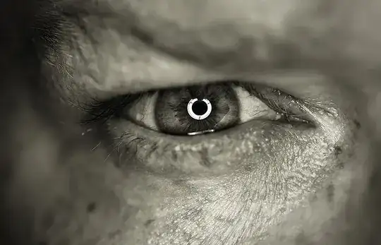 100% crop of a ringlight catchlight