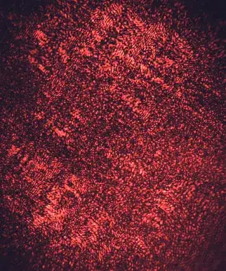 laser speckle on aluminum