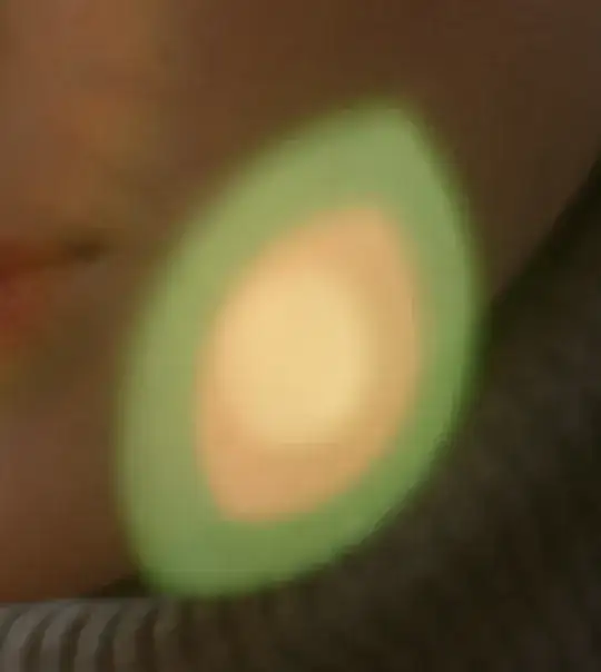 light artifact
