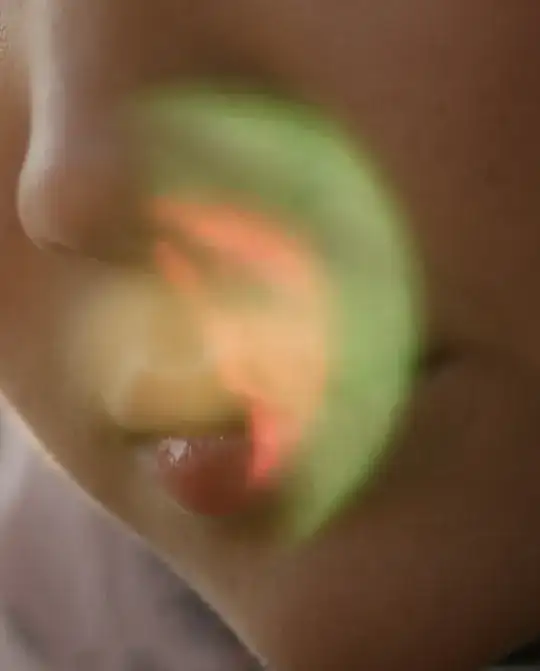 light artifact 2