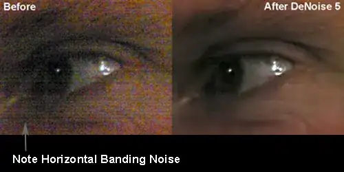 banding
