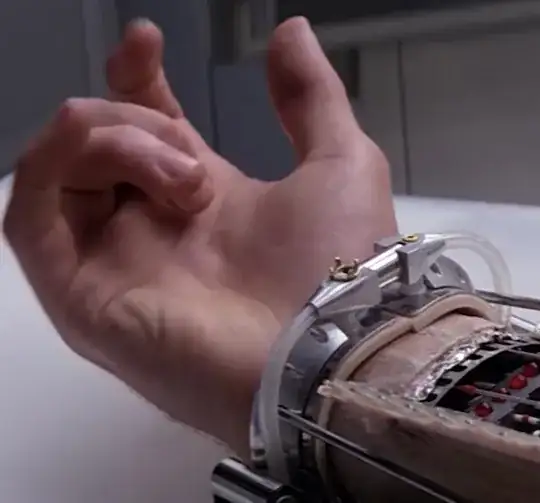 Hand prosthesis