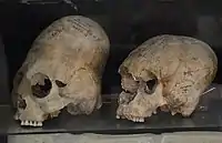 Deformed skulls, Afrasiab, Samarkand, Sogdia, 600–800&nbsp;CE
