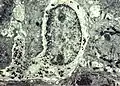 Melanocyte with melanin granules in dendrite. PMID&nbsp;6200593