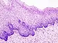 Epitelio cervical normal.