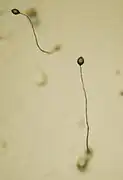 Dictyostelium, 5-cuerpos fructíferos
