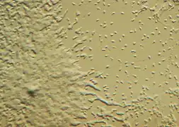 Dictyostelium, 1-mixamebas