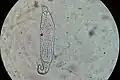 Ejemplar del género Philodina